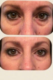 Wilma Schumann Hydrating Collagen Eye Pads (Pack of 5 pairs)
